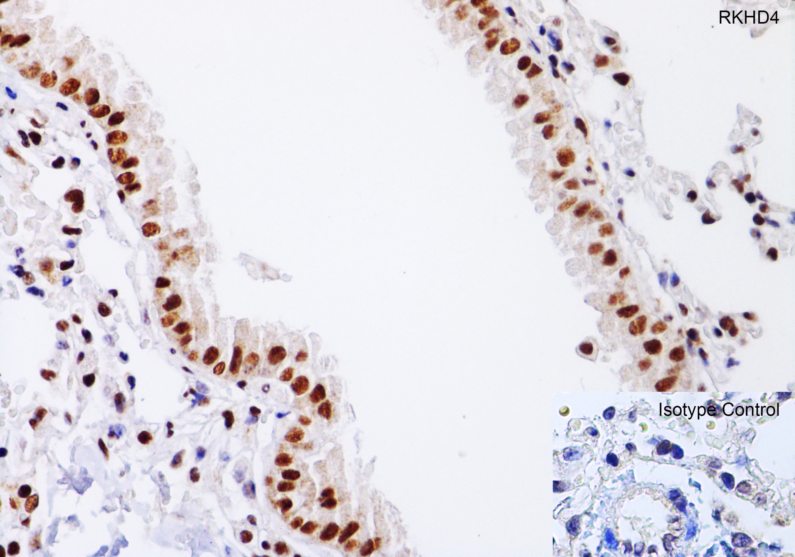 MEX3A Antibody - BSA Free Immunohistochemistry-Paraffin: MEX3A Antibody - BSA Free [NBP2-41092]