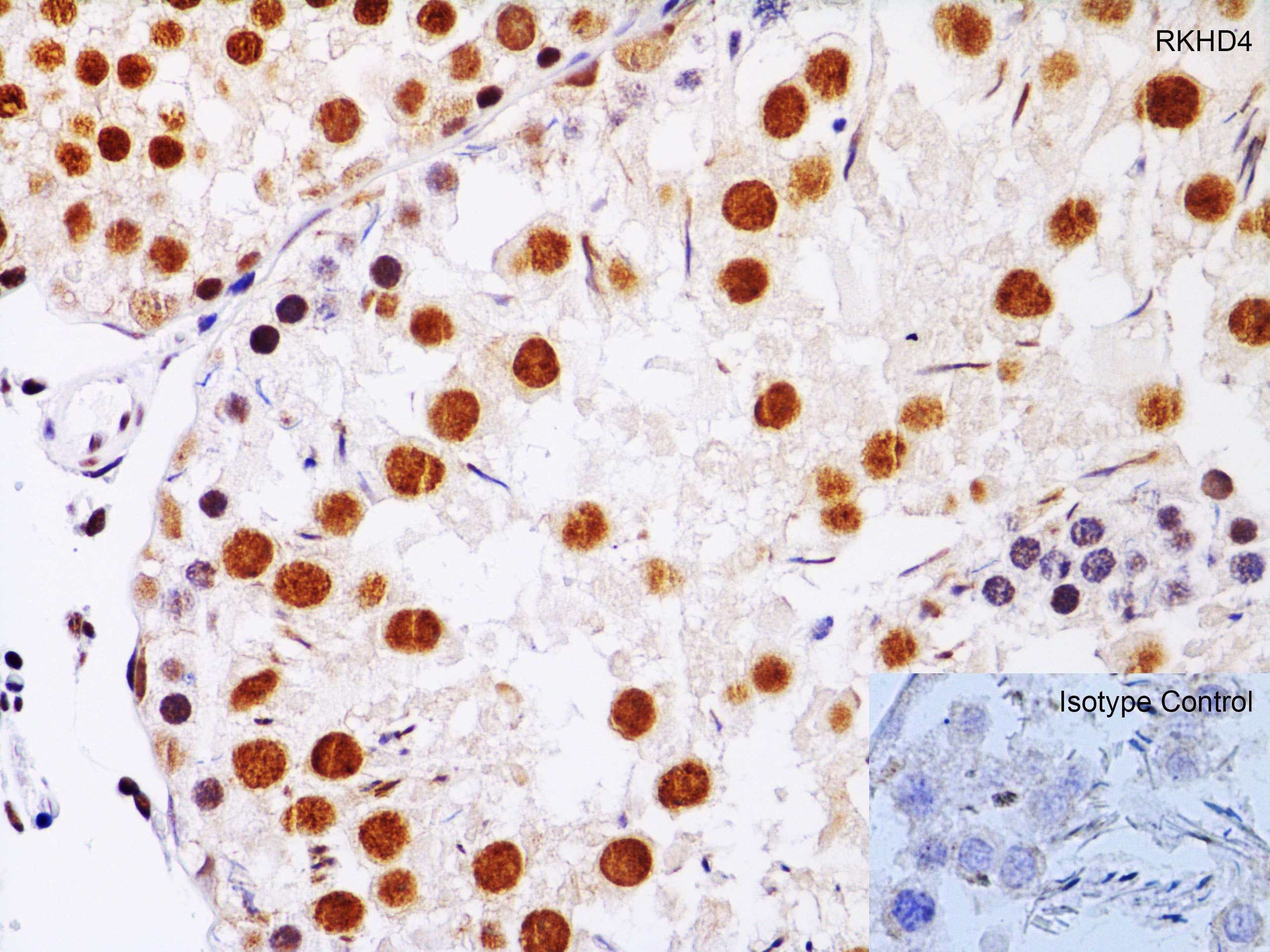 MEX3A Antibody - BSA Free Immunohistochemistry-Paraffin: MEX3A Antibody - BSA Free [NBP2-41092]