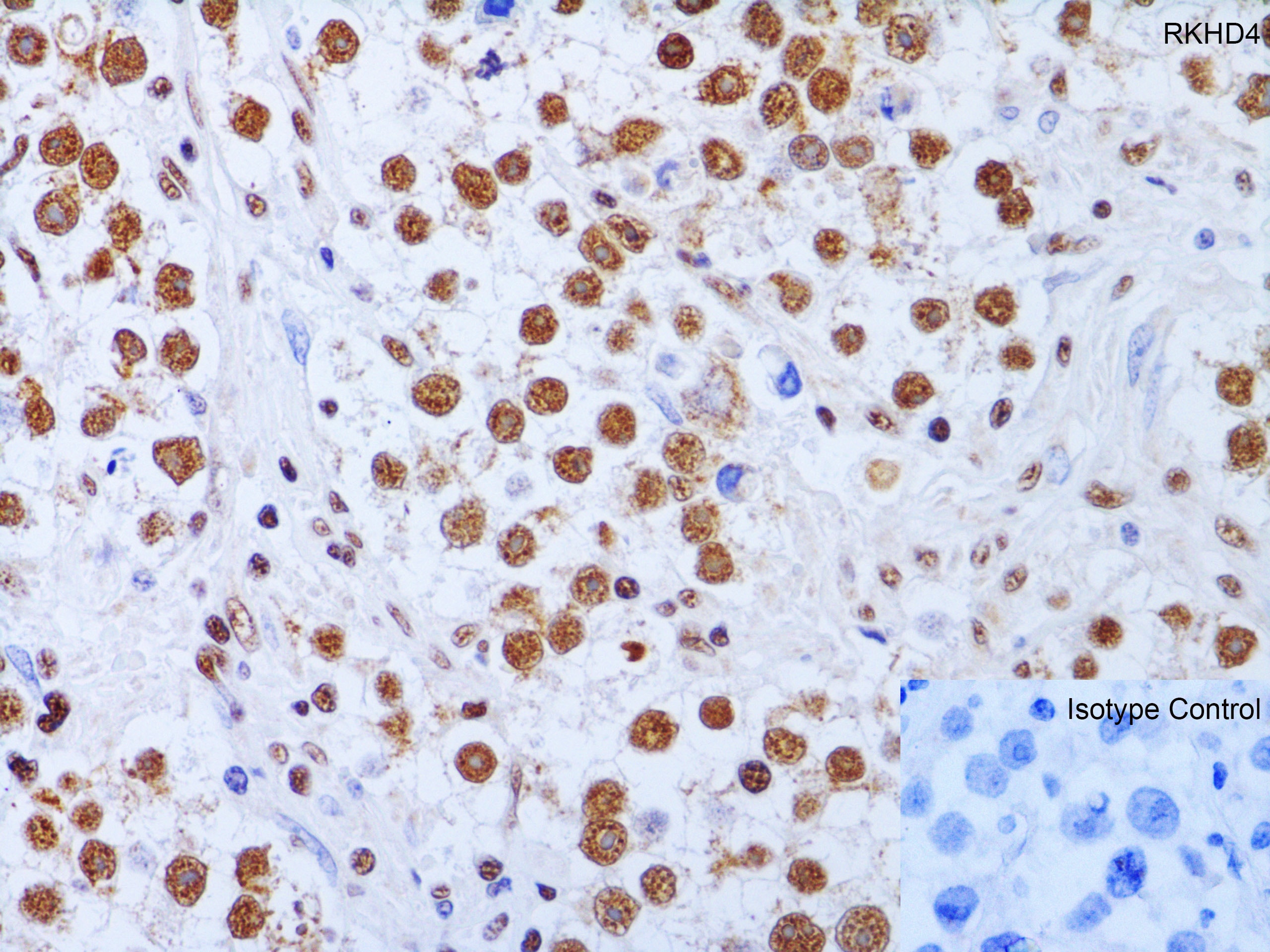 MEX3A Antibody - BSA Free Immunohistochemistry-Paraffin: MEX3A Antibody - BSA Free [NBP2-41092]