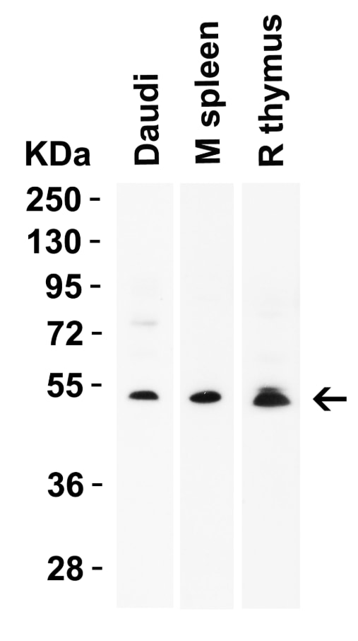 MEX3A Antibody - BSA Free Western Blot: MEX3A Antibody - BSA Free [NBP2-41092]