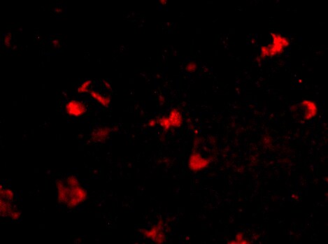 MEX3A Antibody - BSA Free