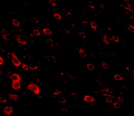 SALM4/LRFN3 Antibody - BSA Free
