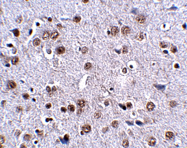 SALM3/LRFN4 Antibody - BSA Free
