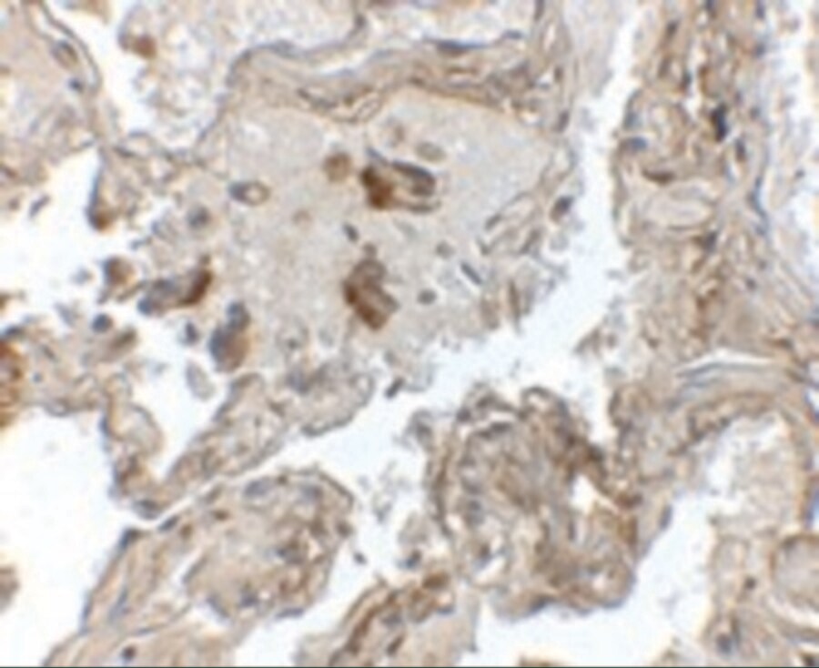 Transthyretin/Prealbumin Antibody - BSA Free