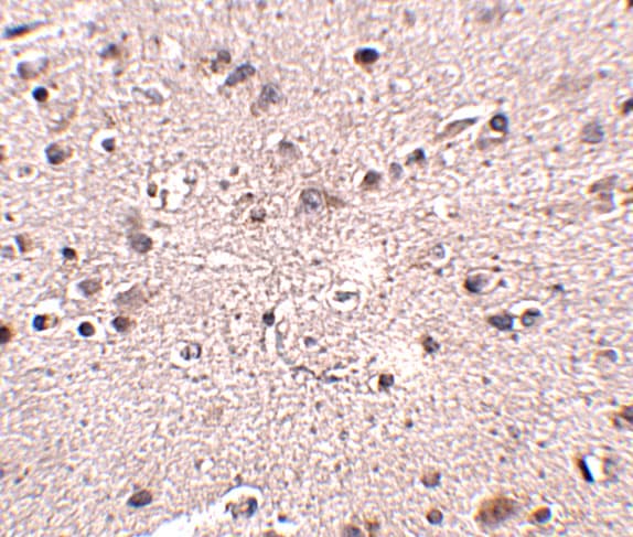 Melanocortin-4 R Antibody - BSA Free