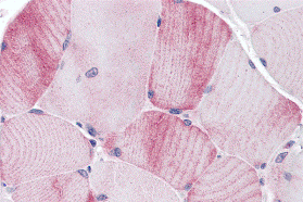 MYBPC1 Antibody - BSA Free