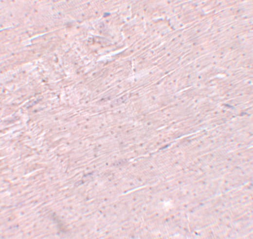 ADAMTSL5 Antibody - BSA Free