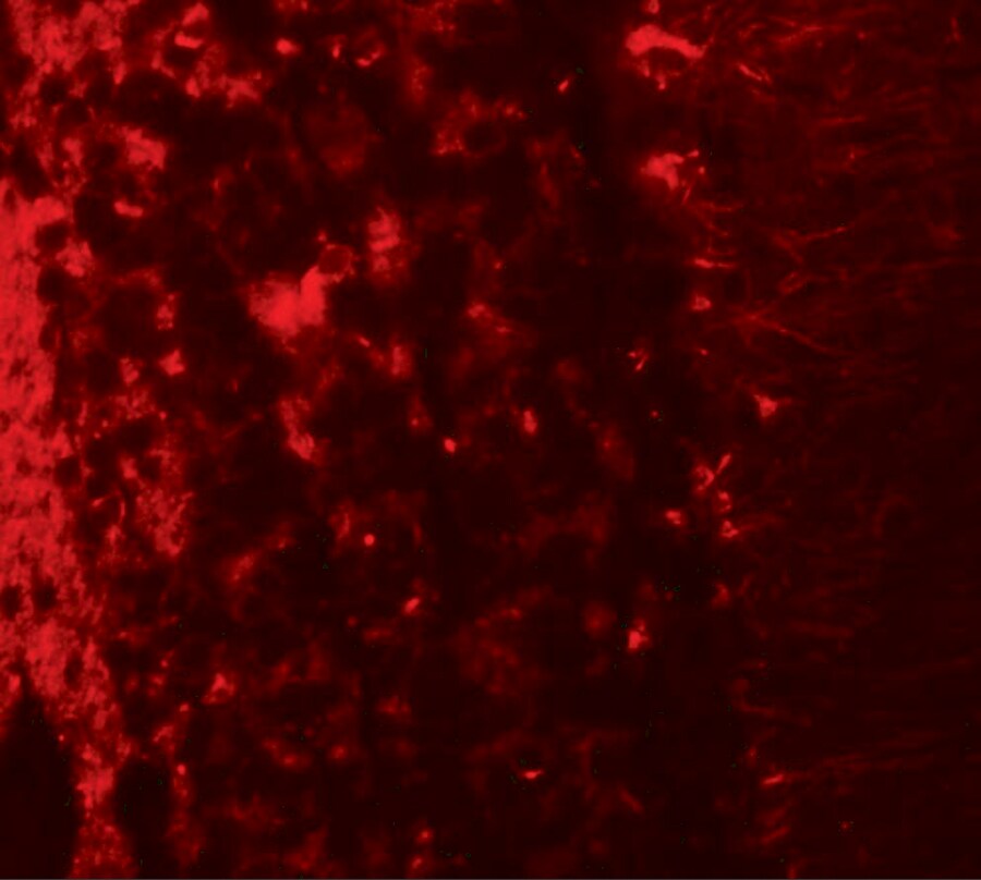 LRRTM2 Antibody - BSA Free