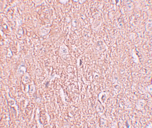 LRRTM2 Antibody - BSA Free