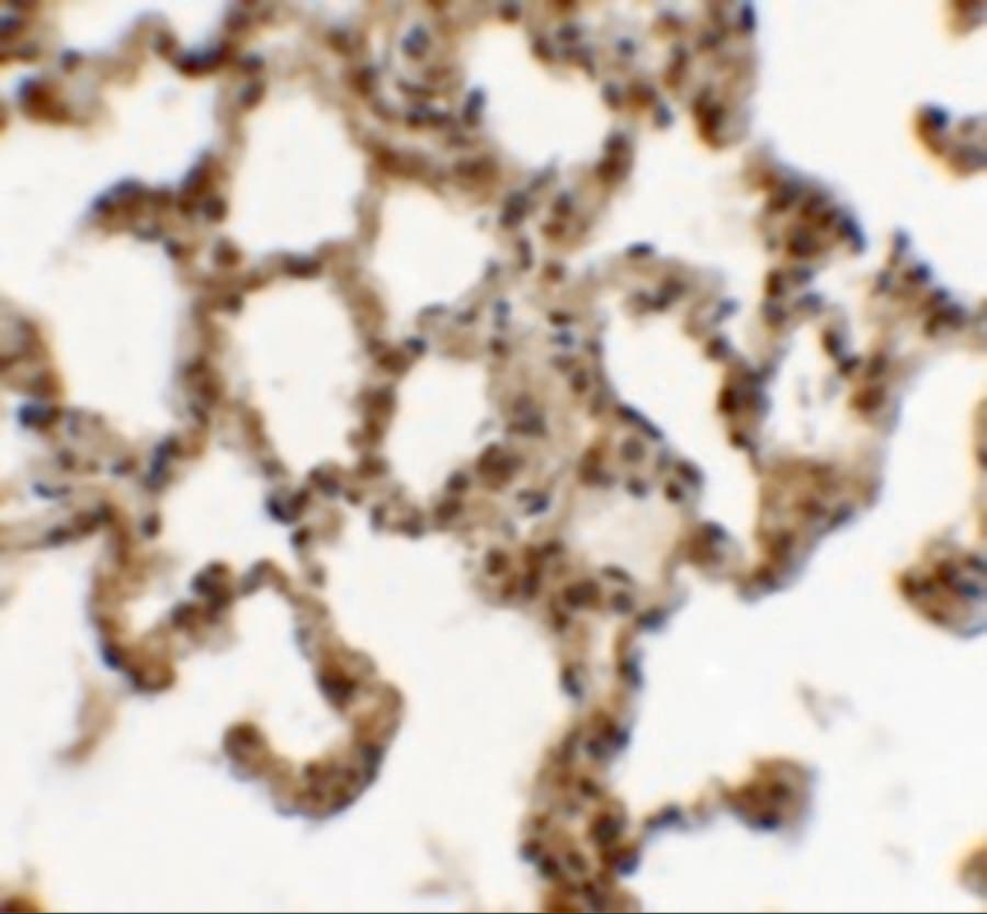 SPINK7 Antibody - BSA Free