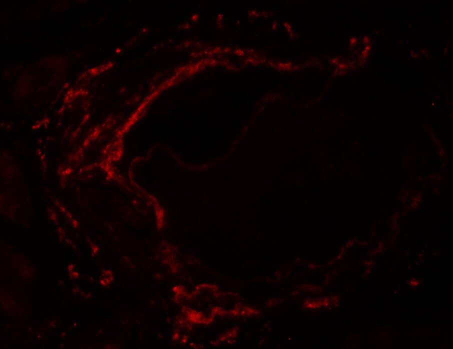 LZTS2 Antibody - BSA Free