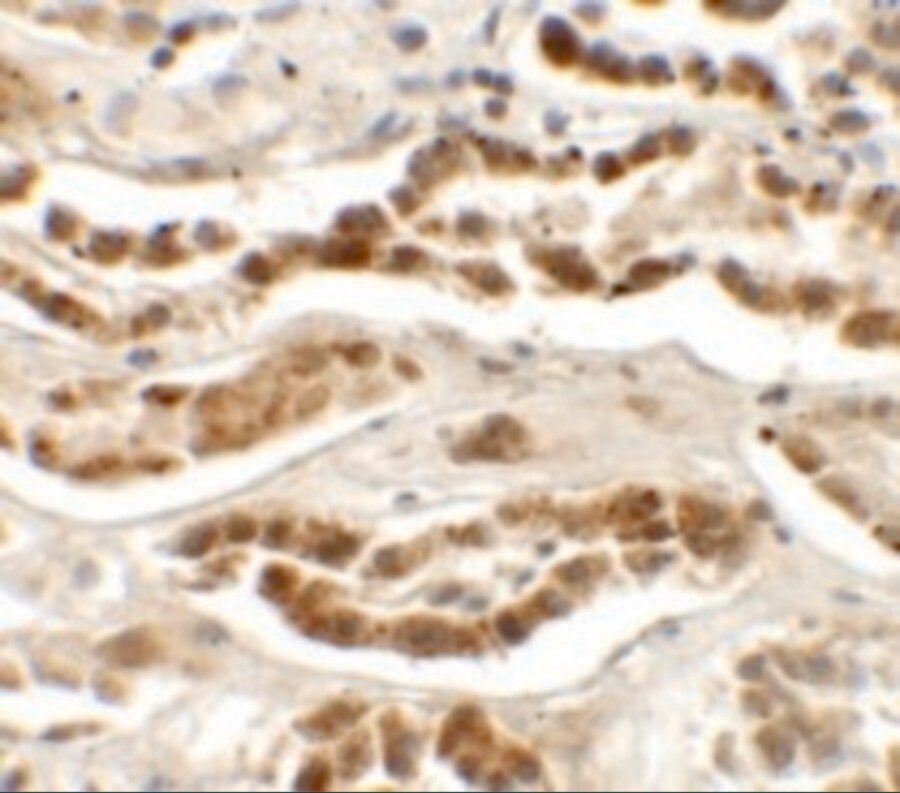 LZTS2 Antibody - BSA Free