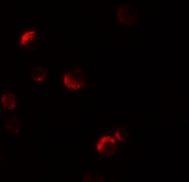 YPEL1 Antibody - BSA Free