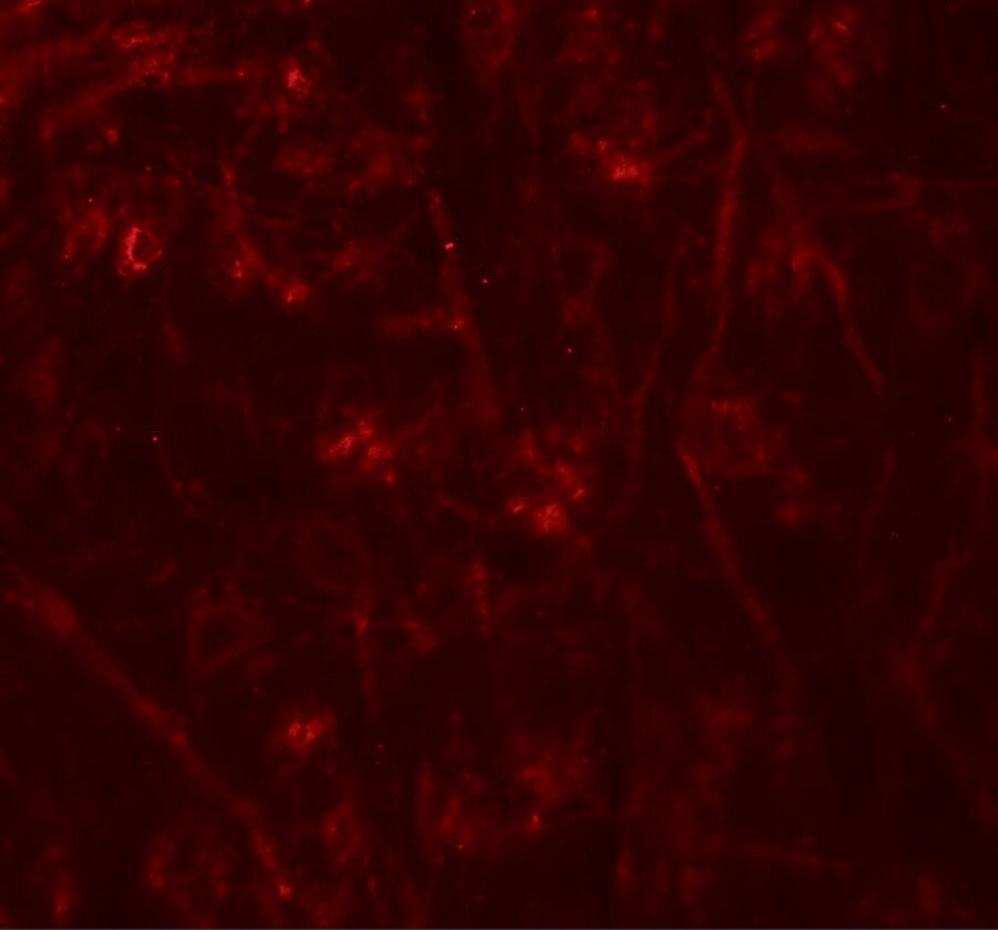 TMEM106A Antibody - BSA Free