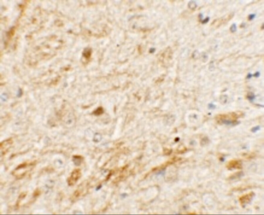 TMEM106A Antibody - BSA Free