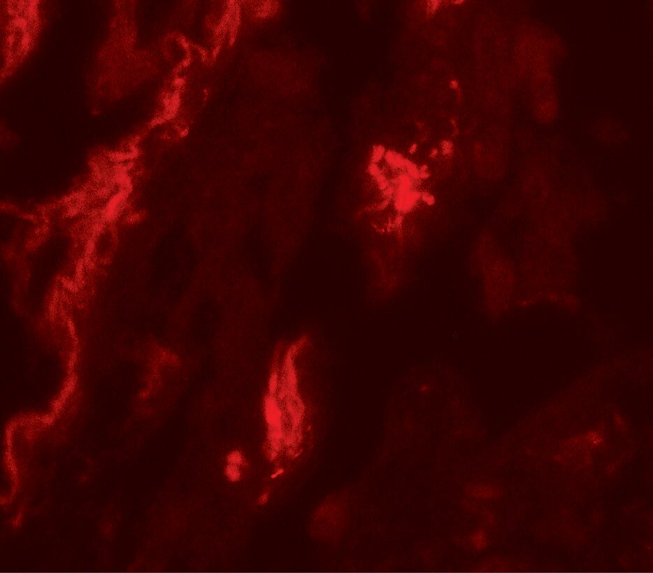 TFEB Antibody - BSA Free