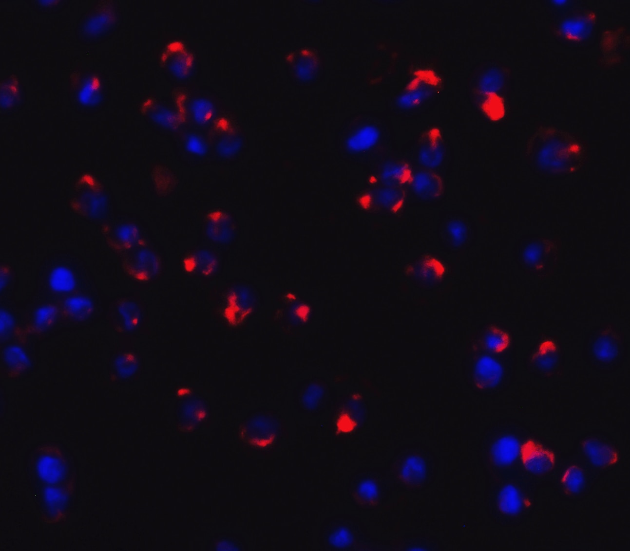 Dectin-1/CLEC7A Antibody - BSA Free