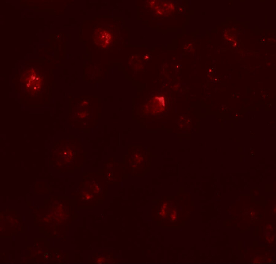 ZNF687 Antibody - BSA Free