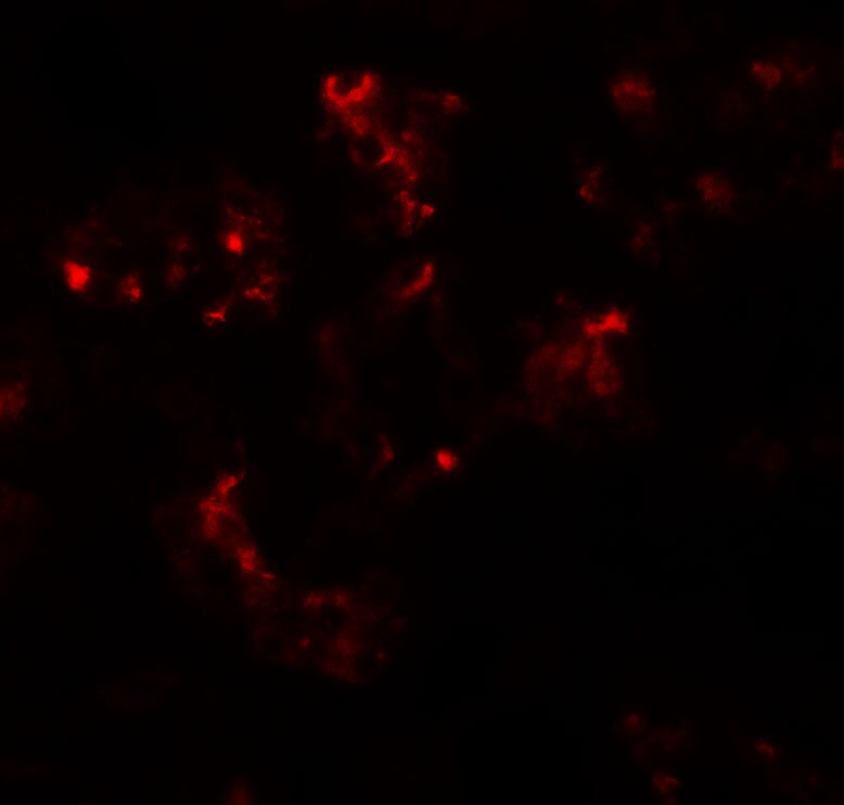 TTYH2 Antibody - BSA Free