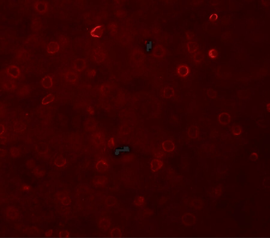 TRACP/PAP/ACP5 Antibody - BSA Free