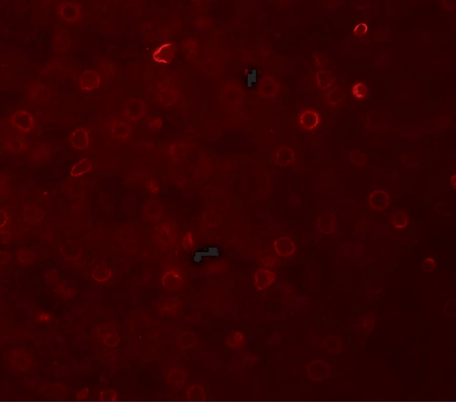 TRACP/PAP/ACP5 Antibody - BSA Free