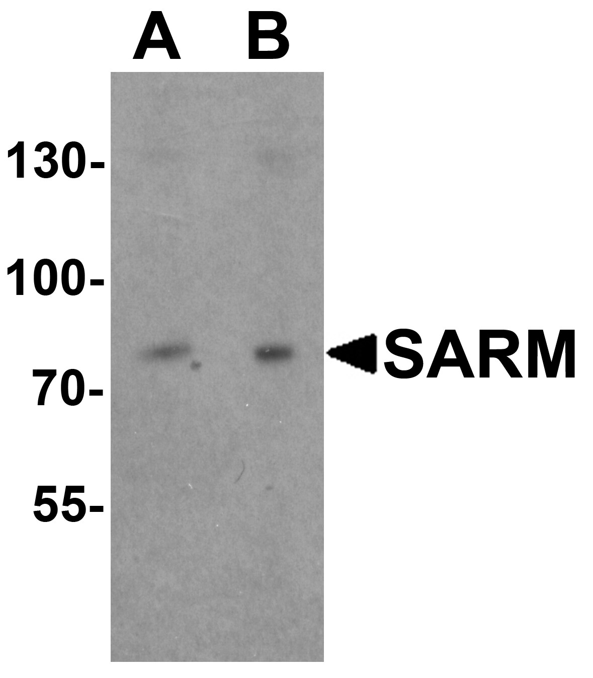 SARM1 Antibody - BSA Free