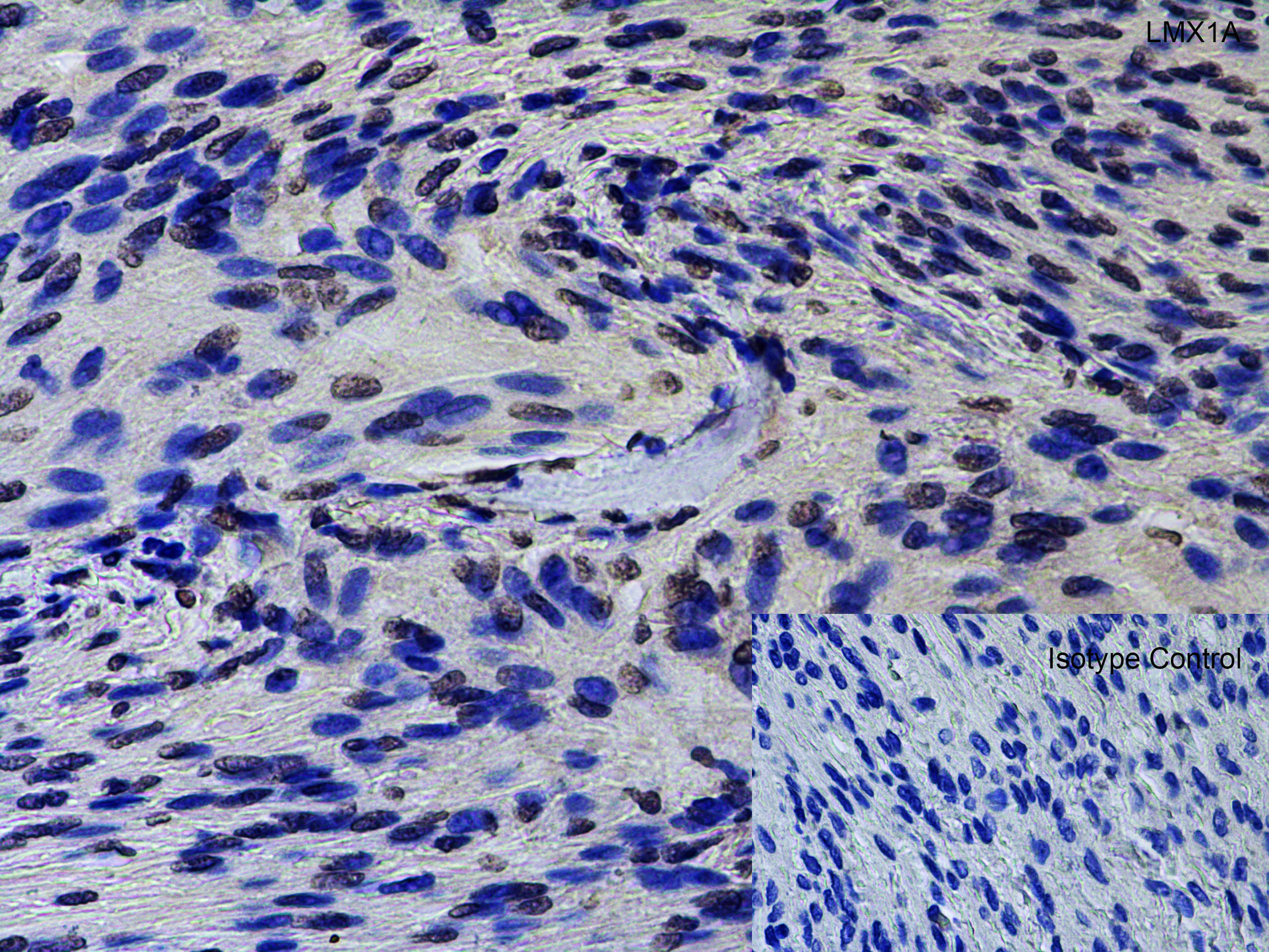 LMX1A Antibody - BSA Free