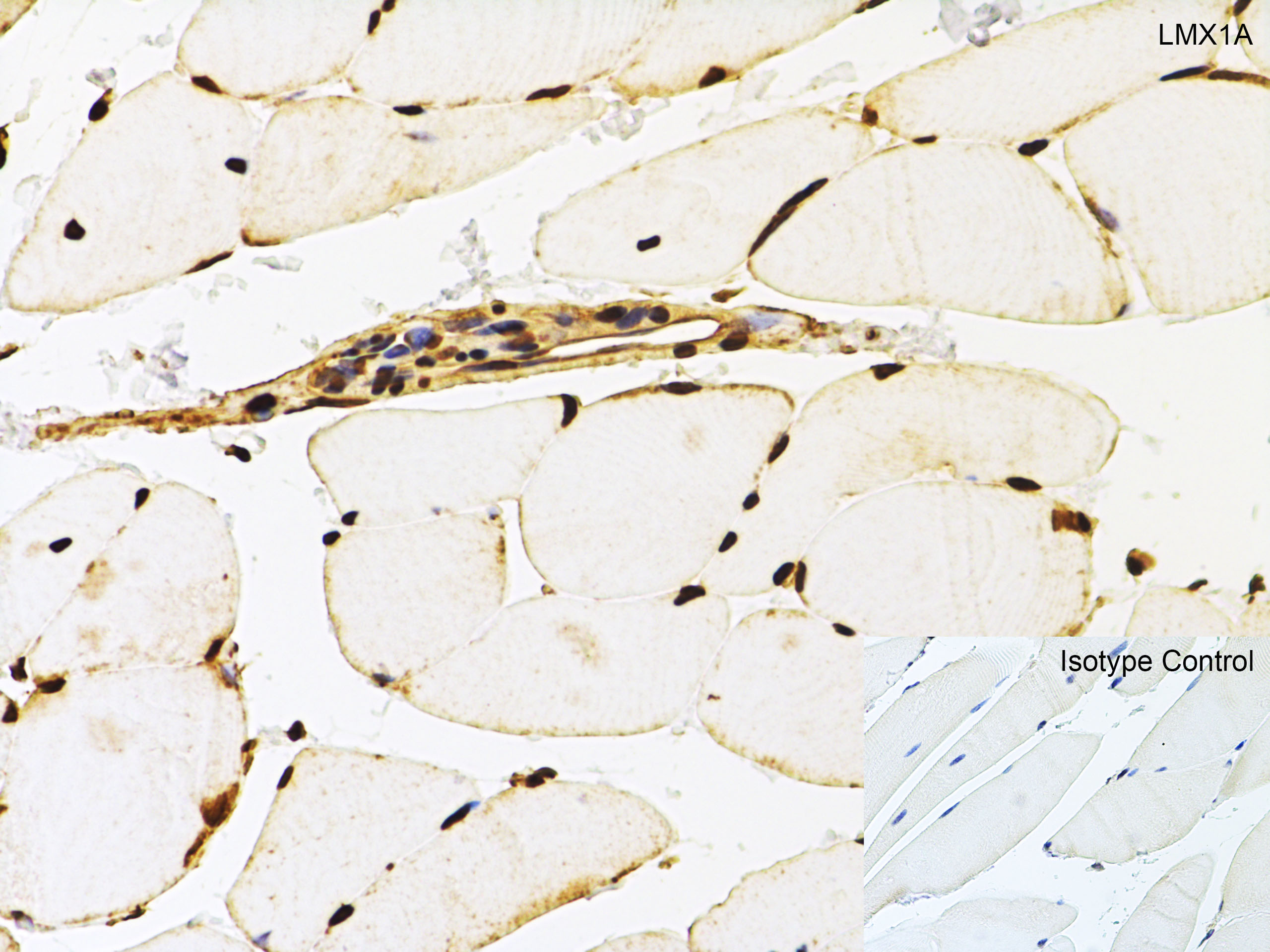 LMX1A Antibody - BSA Free