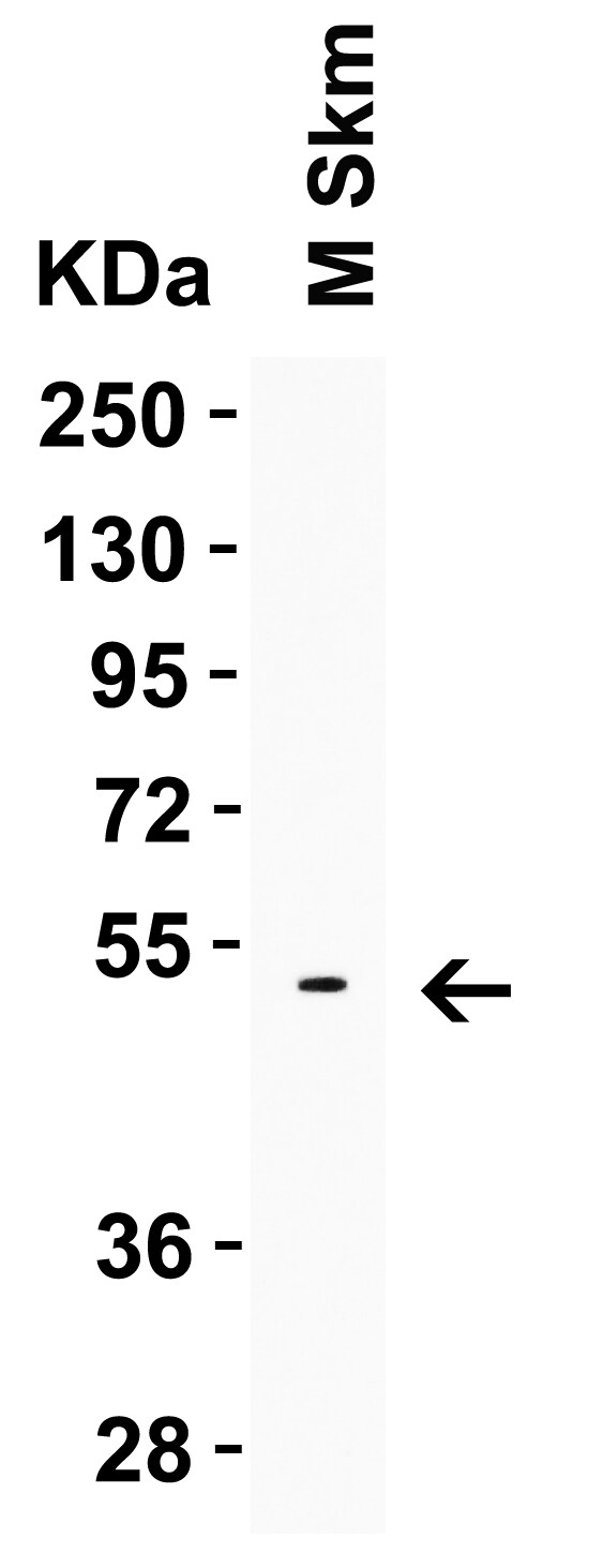 LMX1A Antibody - BSA Free