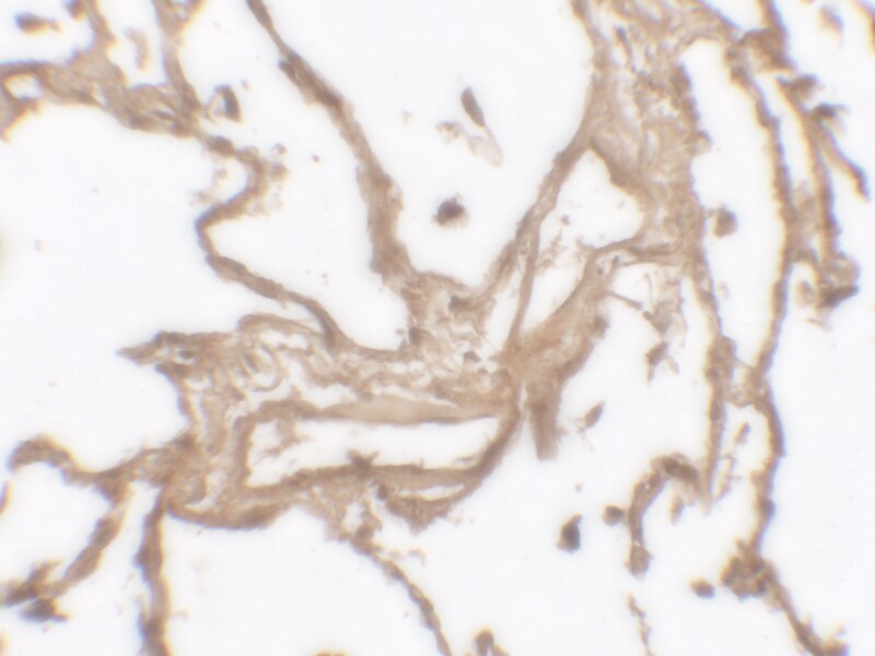 MMP-9 Antibody - BSA Free
