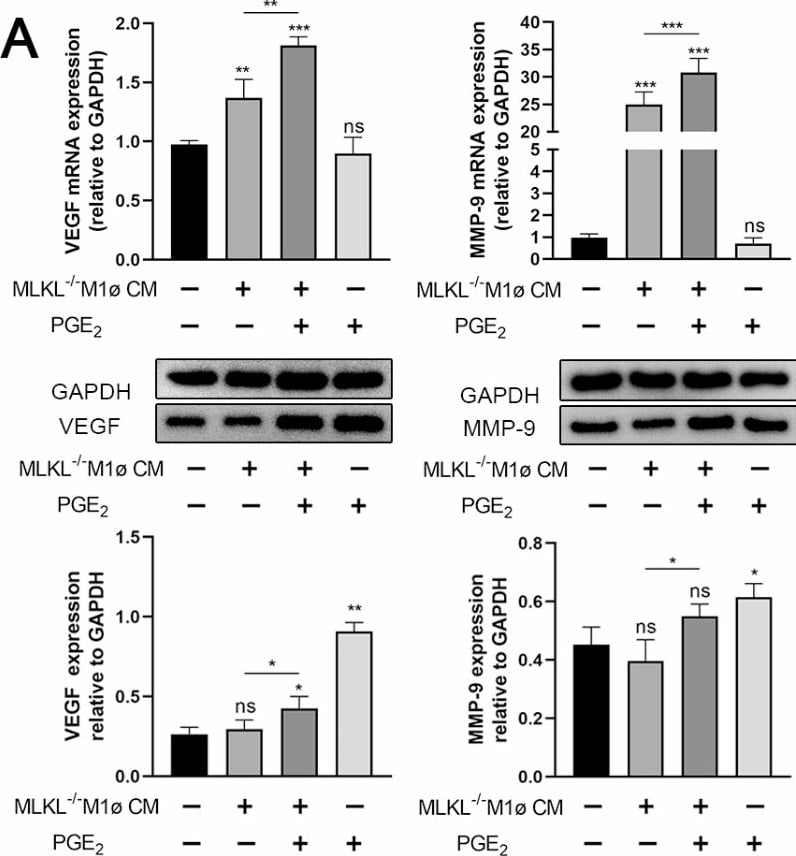 MMP-9 Antibody - BSA Free