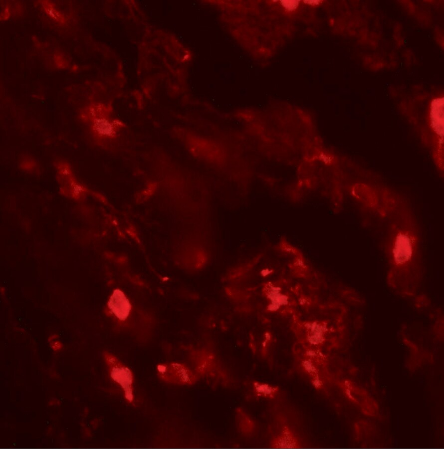 IL-36 beta/IL-1F8 Antibody - BSA Free