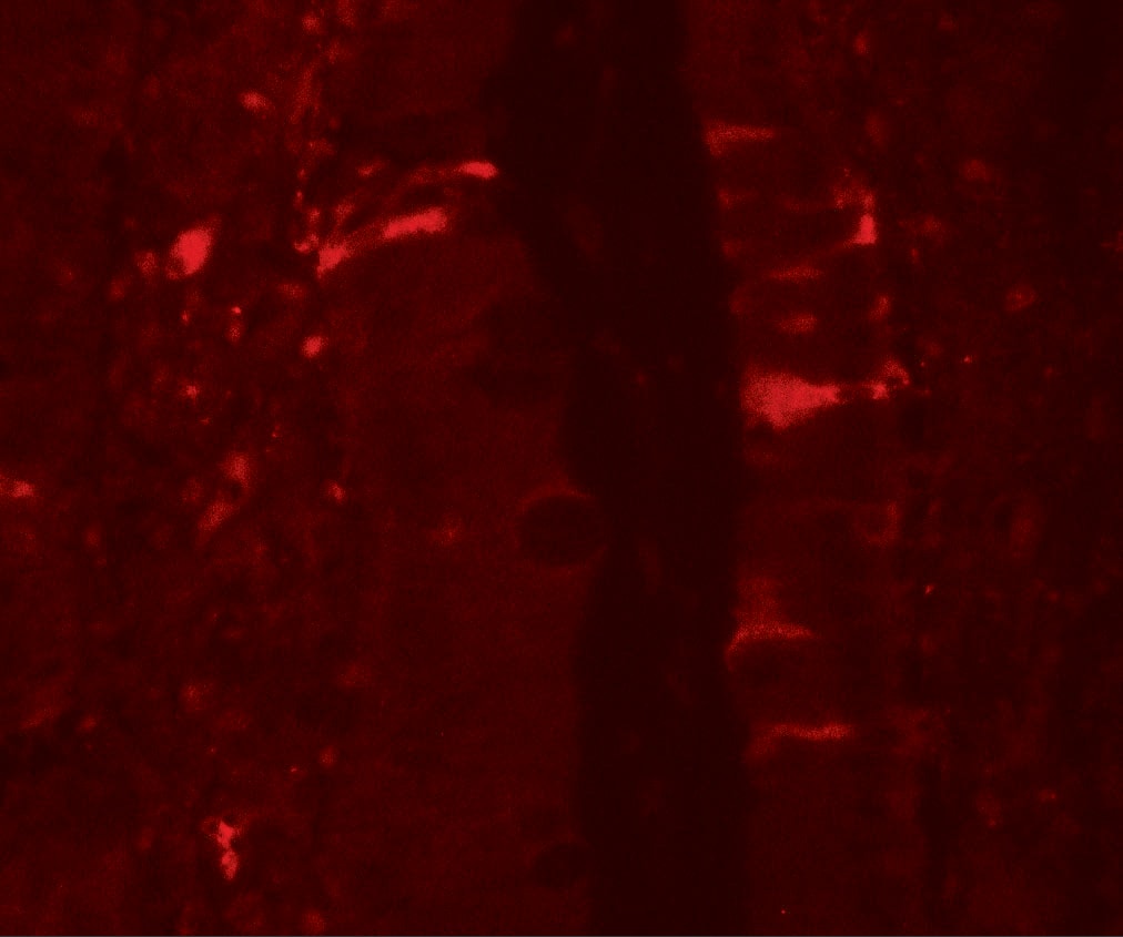IL-36Ra/IL-1F5 Antibody - BSA Free