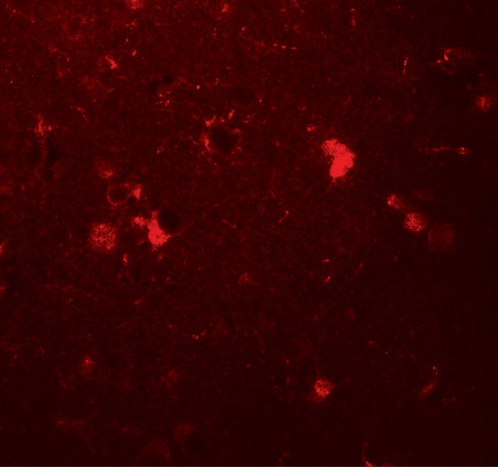 ULK3 Antibody - BSA Free