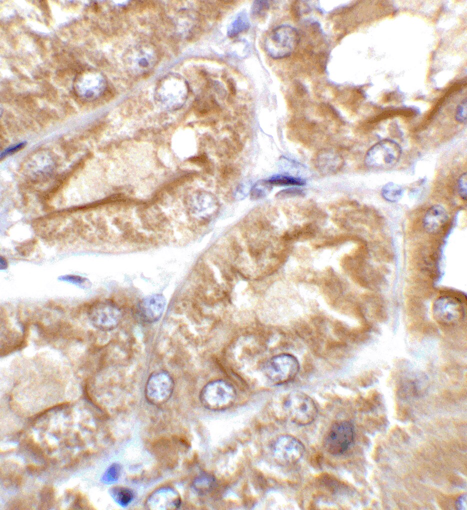 TRPV4 Antibody - BSA Free