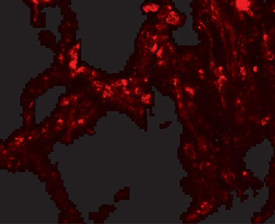 TRPV4 Antibody - BSA Free