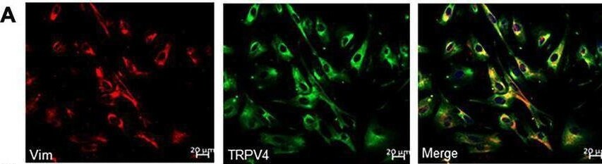 TRPV4 Antibody - BSA Free