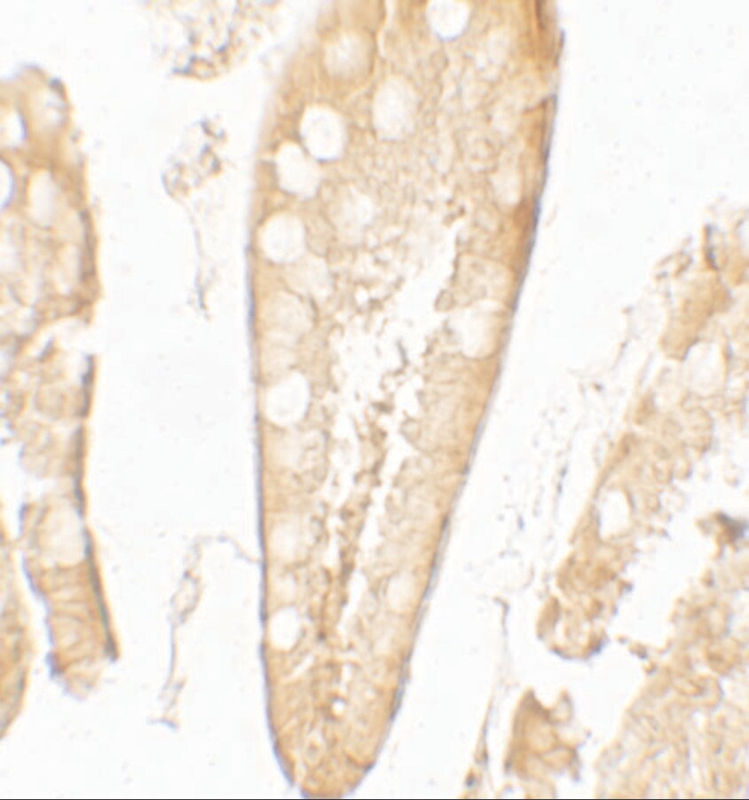 CFTR Antibody - BSA Free