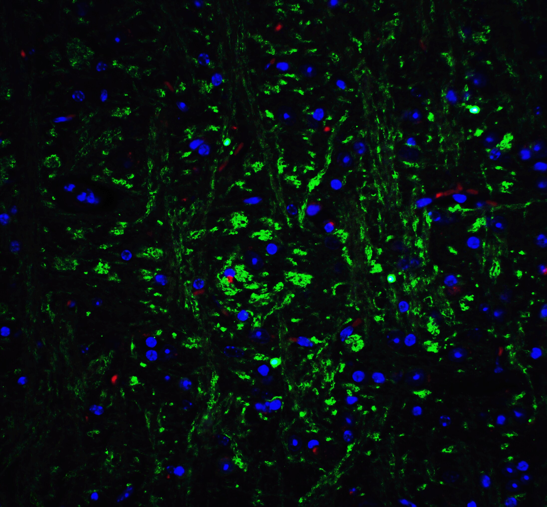 Olig2 Antibody - BSA Free