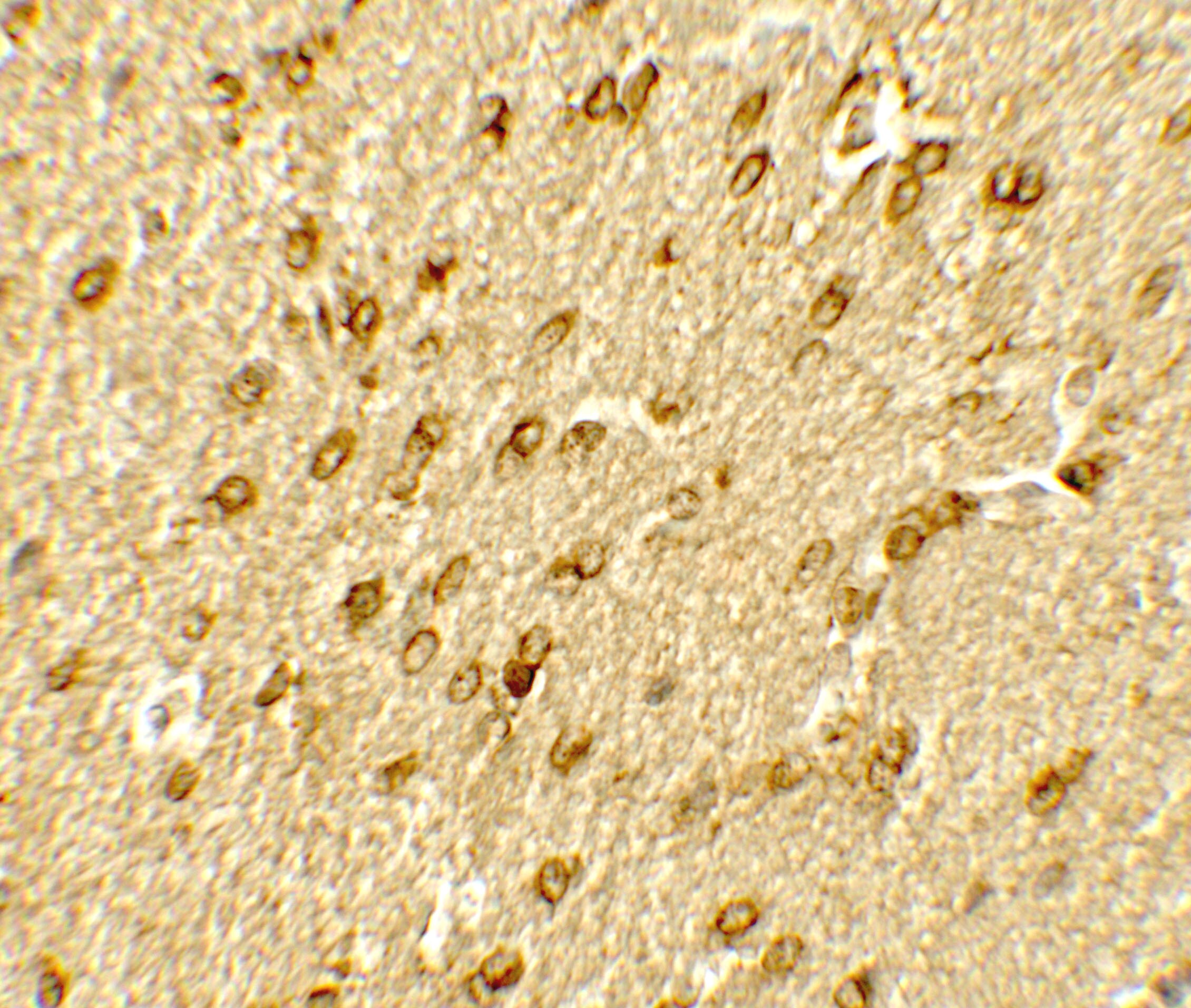 Brg1 Antibody - BSA Free