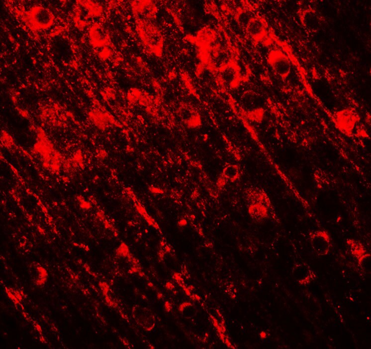 Brg1 Antibody - BSA Free