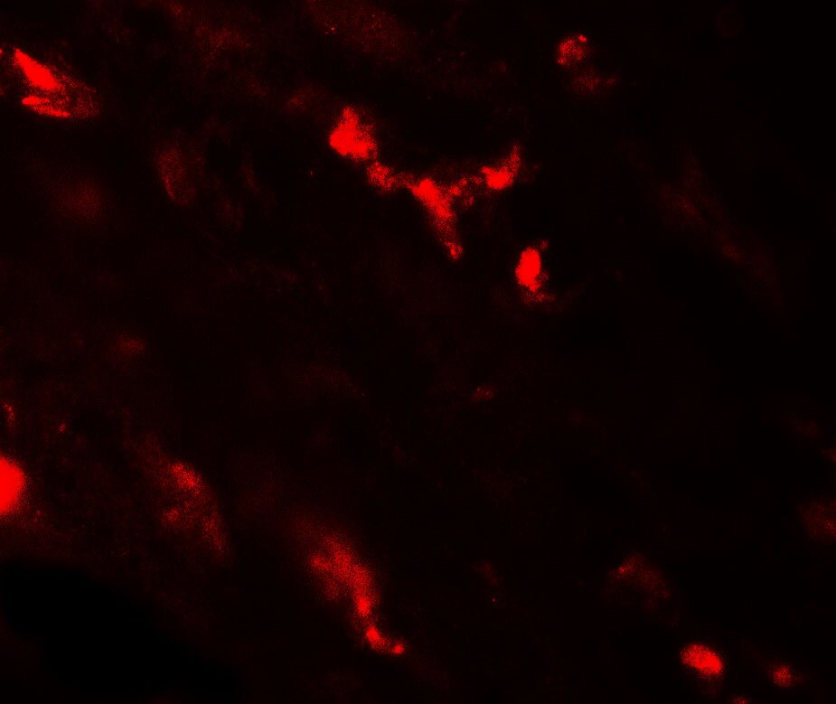 Calcium-sensing R/CaSR Antibody - BSA Free