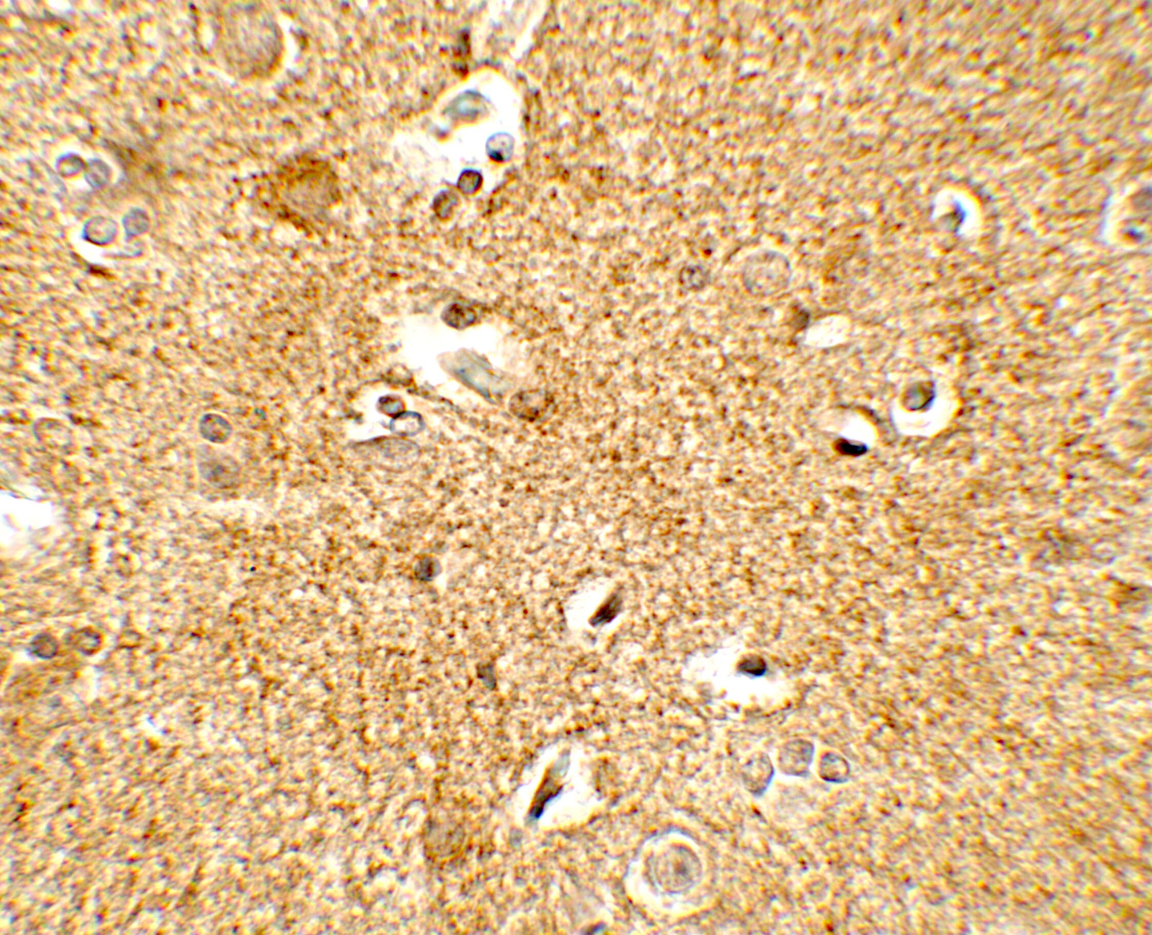 Corticotropin Releasing Factor Antibody - BSA Free