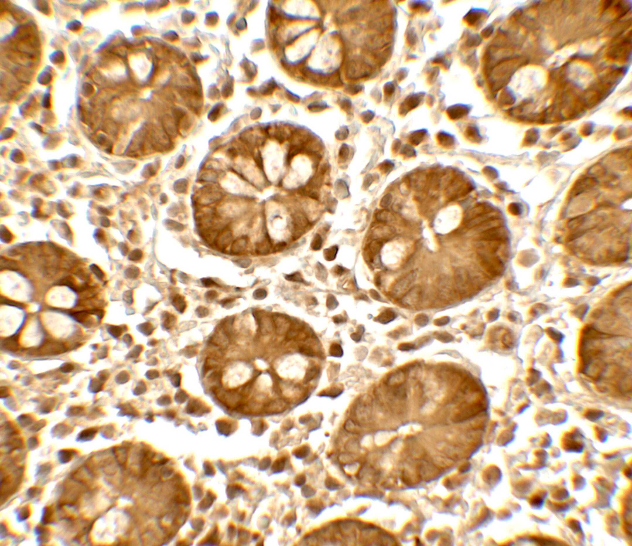 TICRR Antibody - BSA Free