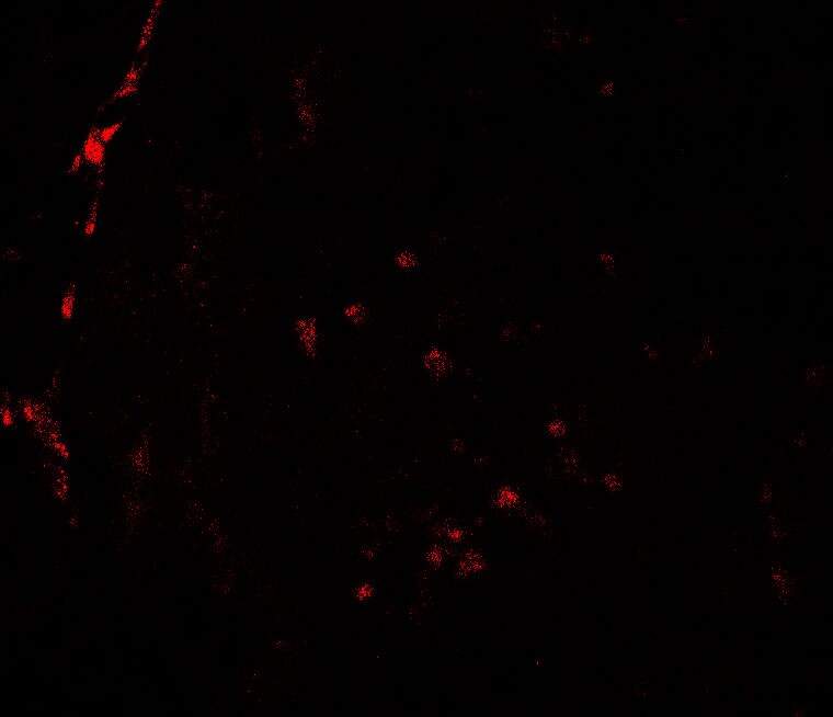 Histone Deacetylase 2/HDAC2 Antibody - BSA Free