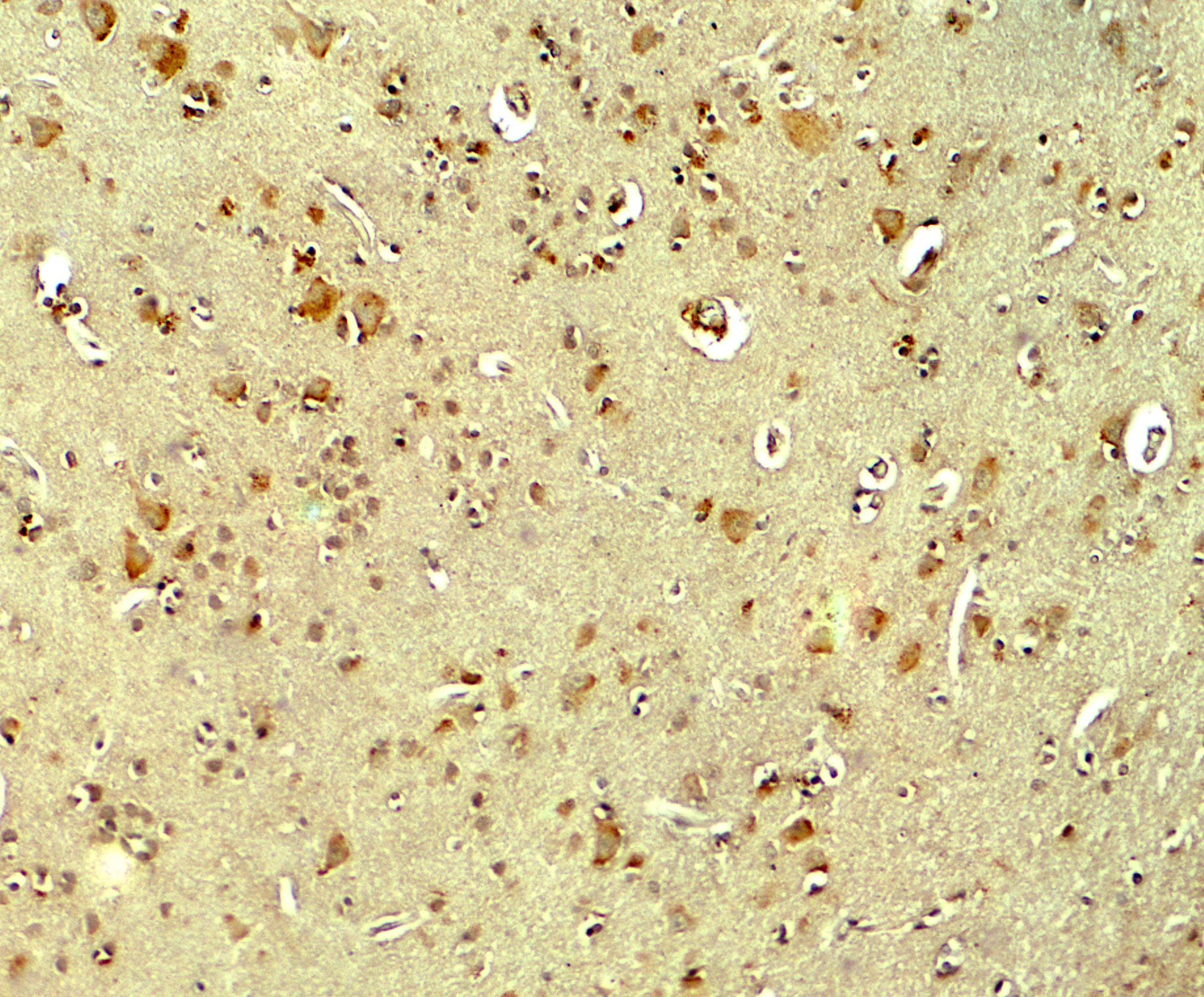 Parkin Antibody - BSA Free