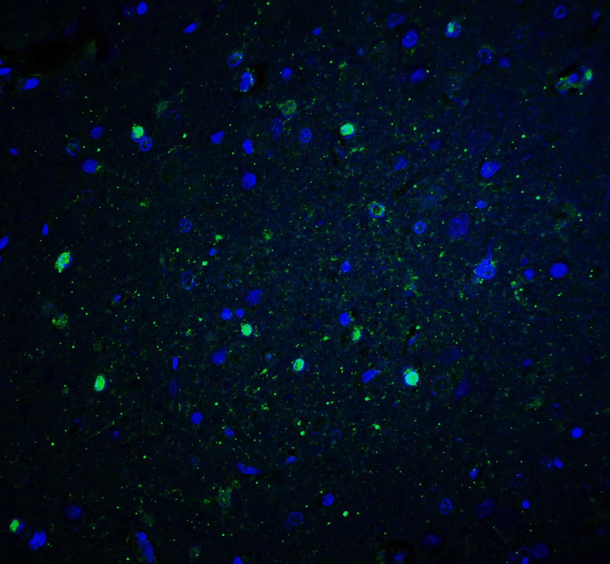 CYBB/NOX2 Antibody - BSA Free