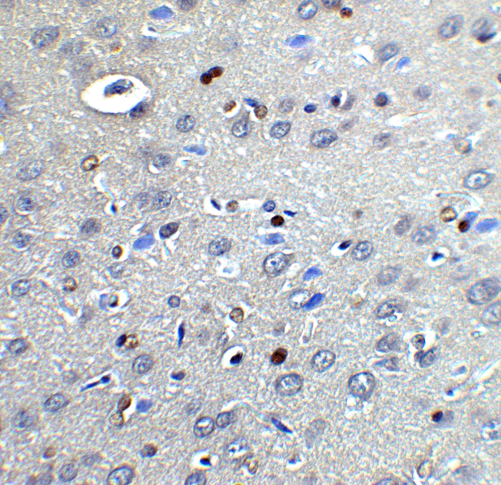 CYBB/NOX2 Antibody - BSA Free