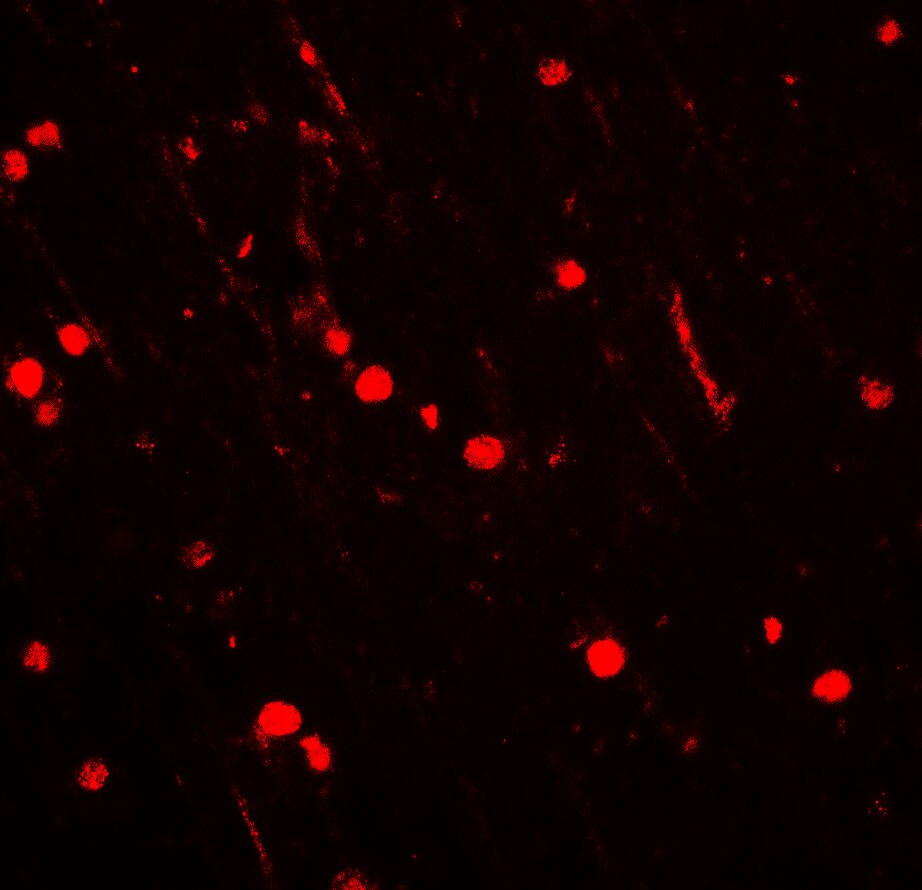 CYBB/NOX2 Antibody - BSA Free