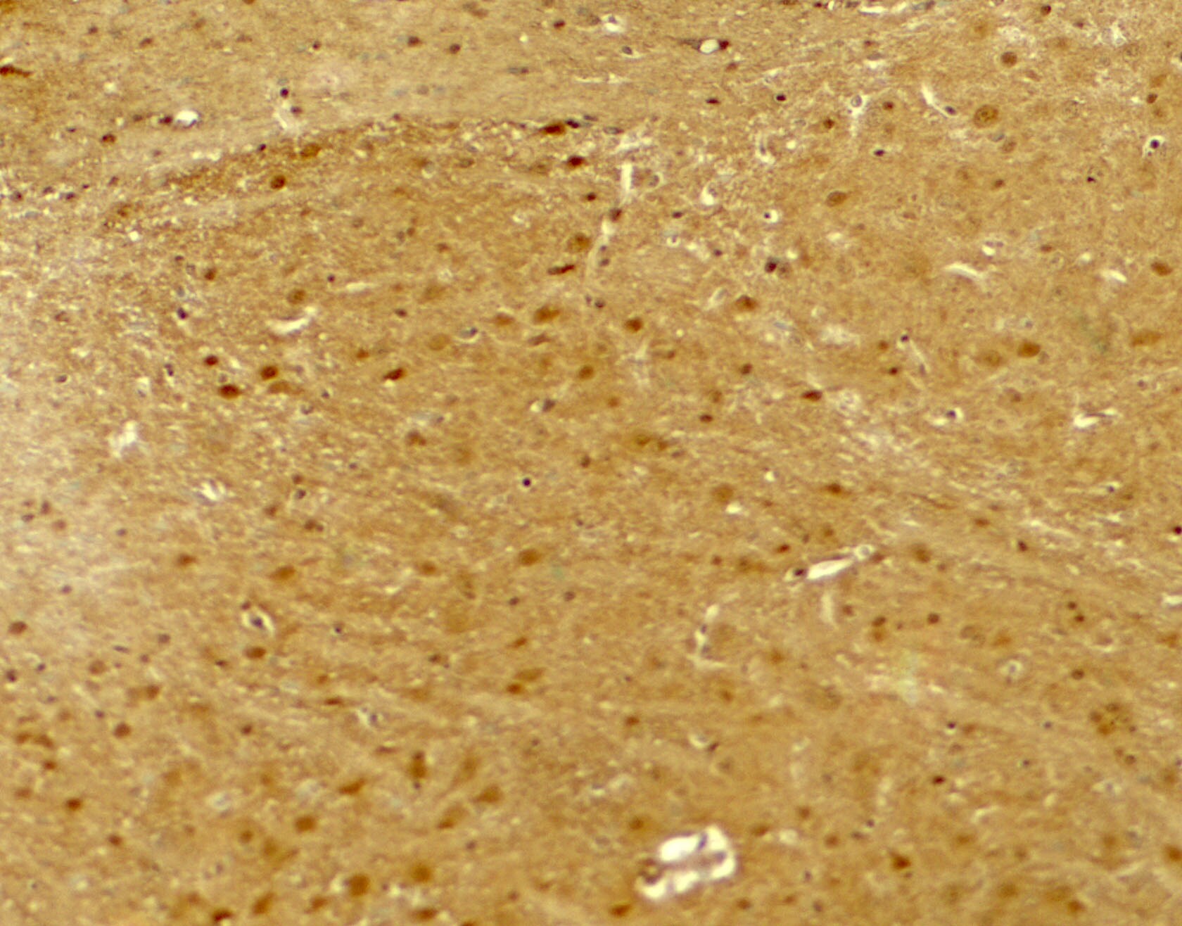 Neuroligin 2/NLGN2 Antibody - BSA Free